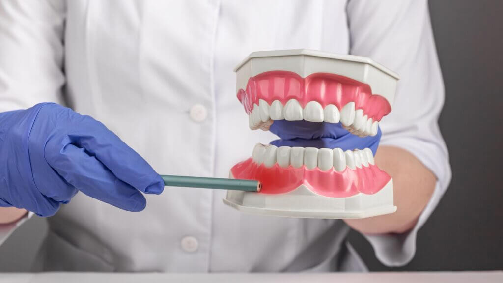 طريقة التخلص من تسوس الأسنان في يوم واحد